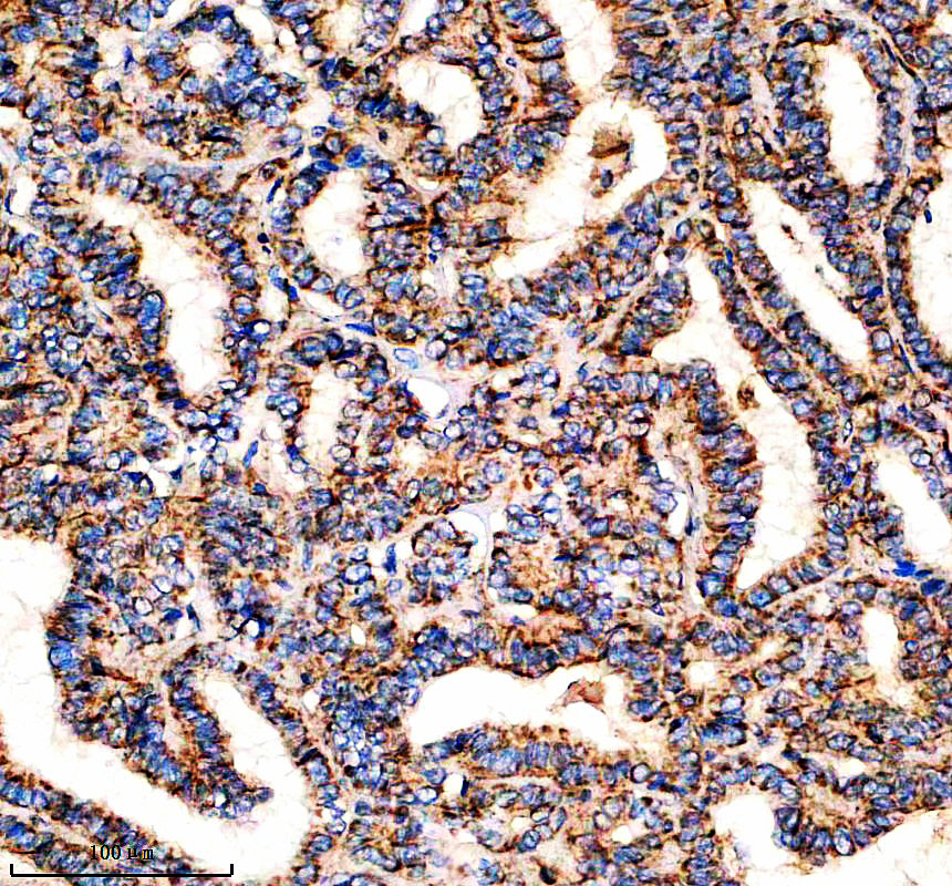 IHC analysis of SPCS2 using anti-SPCS2 antibody (A13430-1)