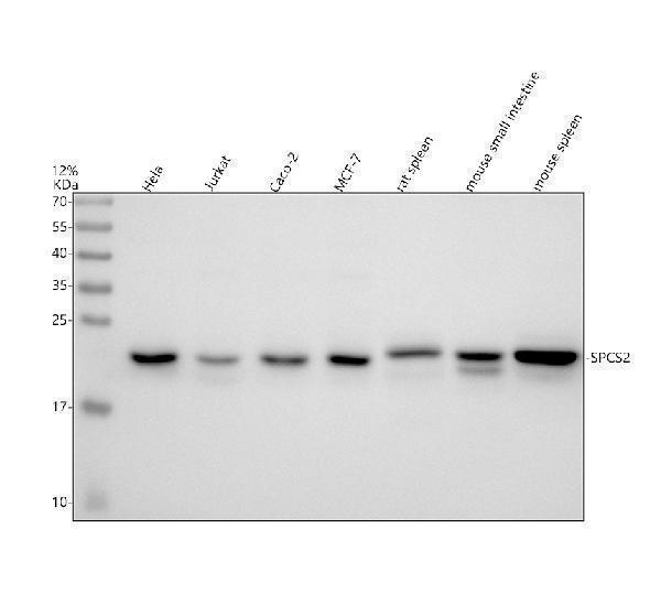 Western blot analysis of SPCS2 using anti-SPCS2 antibody (A13430-1)