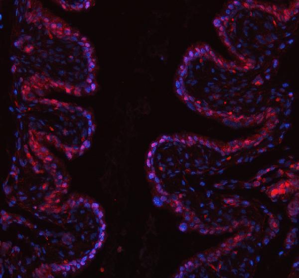 a13434 1 pus7 primary antibodies if testing 2
