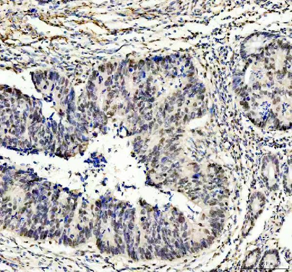 IHC analysis of PUS7 using anti-PUS7 antibody (A13434-1)