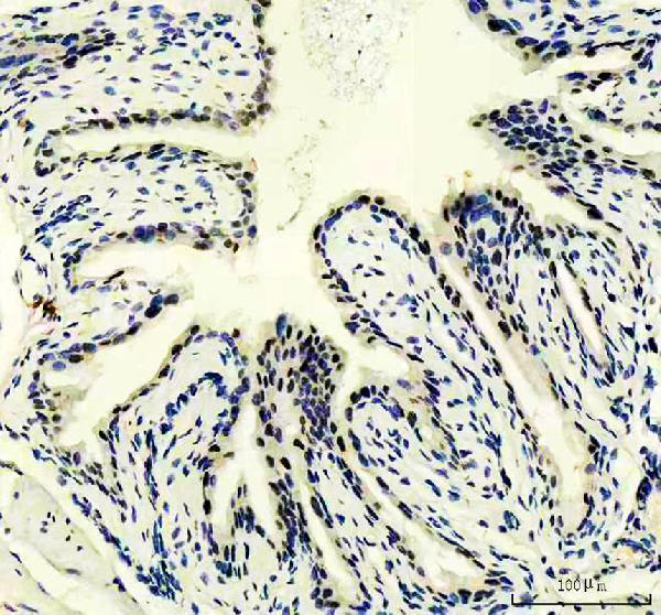 IHC analysis of PUS7 using anti-PUS7 antibody (A13434-1)