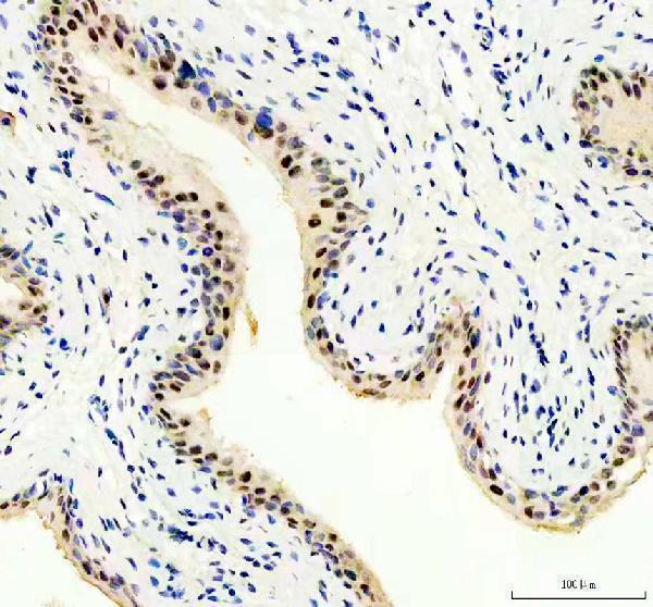 a13434 1 pus7 primary antibodies ihc testing 3