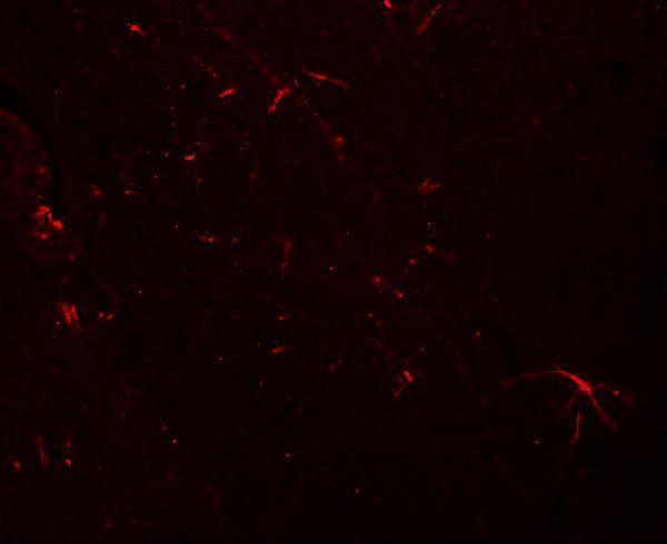 a13438 tmem204 primary antibodies if testing 3