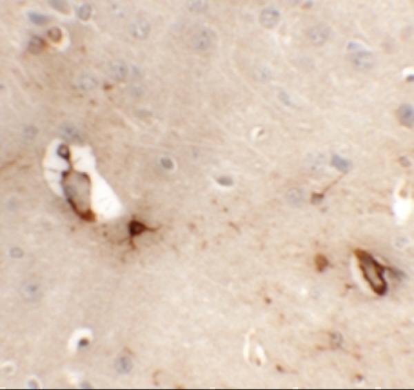 a13438 tmem204 primary antibodies ihc testing 2
