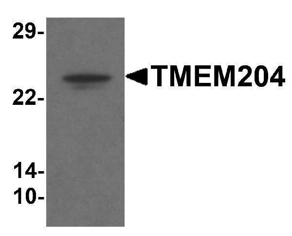 a13438 tmem204 primary antibodies wb testing 1