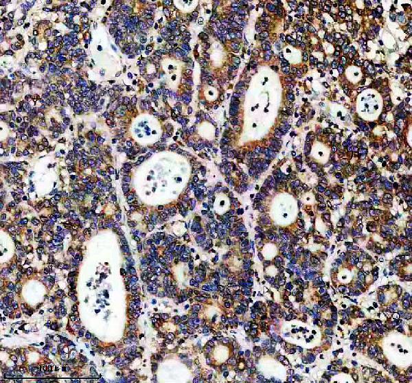 a13448 1 dnajb12 primary antibodies ihc testing 2