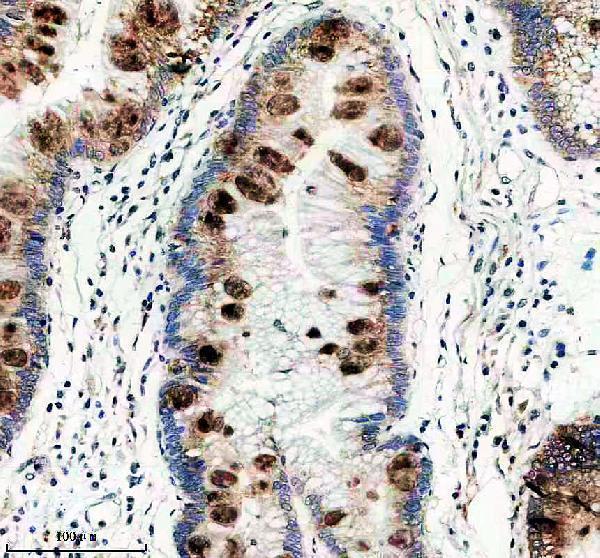 a13448 1 dnajb12 primary antibodies ihc testing 3