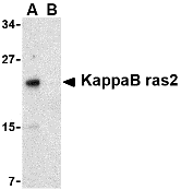 Western blot analysis of KappaB ras2 in RAW264