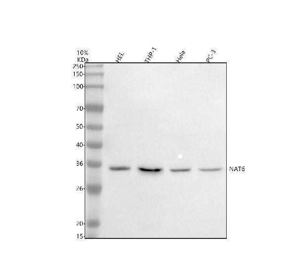  Western blot analysis of NAT6/FUS2/NAA80 using anti-NAT6/FUS2/NAA80 antibody (A13474-1)