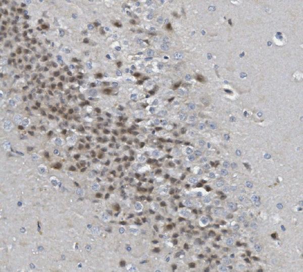 a13507 2 rad9b primary antibodies ihc testing 3