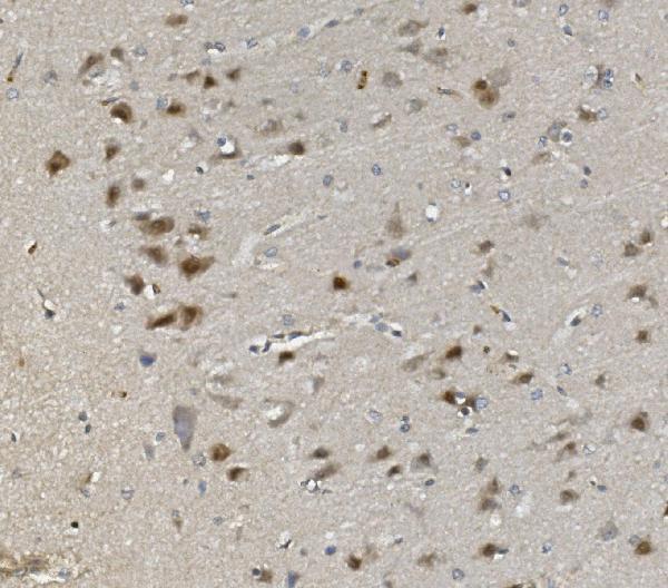 a13507 2 rad9b primary antibodies ihc testing 4