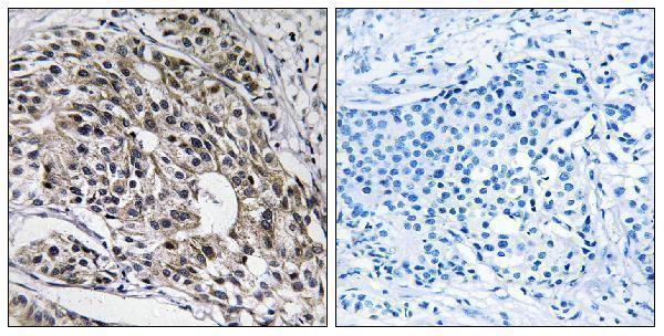 a13508 1 mrpl13 primary antibodies ihc testing 1