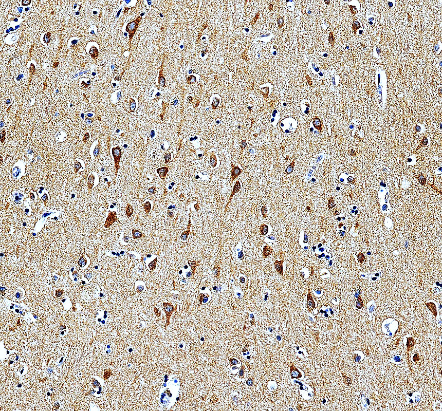 IHC analysis of MRPL13 using anti-MRPL13 antibody (A13508-3)