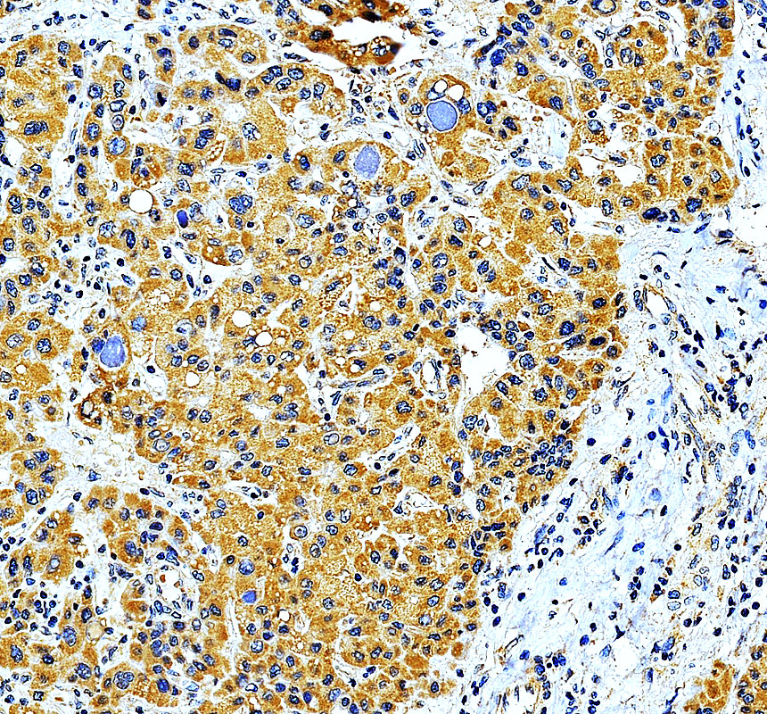 IHC analysis of MRPL13 using anti-MRPL13 antibody (A13508-3)