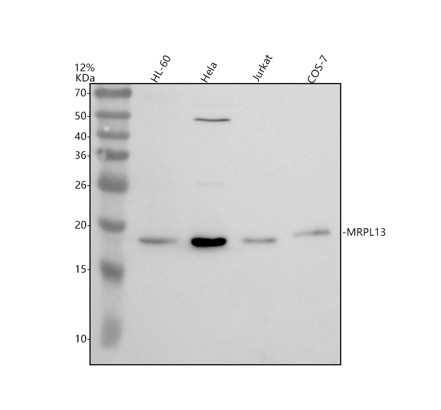 Western blot analysis of MRPL13 using anti-MRPL13 antibody (A13508-3)