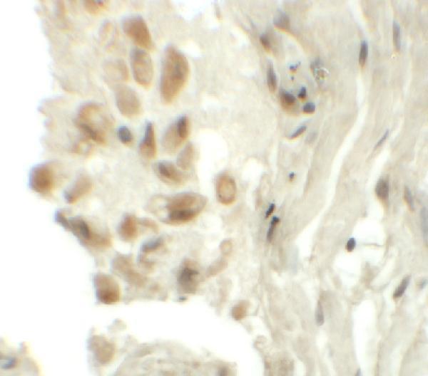 Immunohistochemistry of TYW1 in human lung tissue with TYW1 antibody at 5 μg/mL