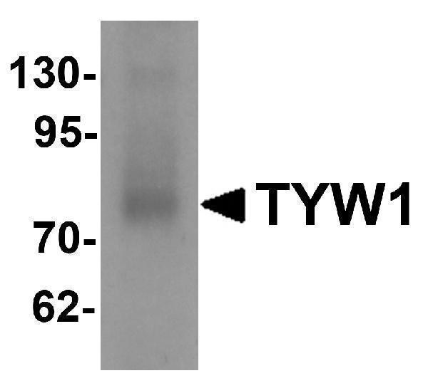 Western blot analysis of TYW1 in human lung tissue lysate with TYW1 antibody at 1 μg/mL