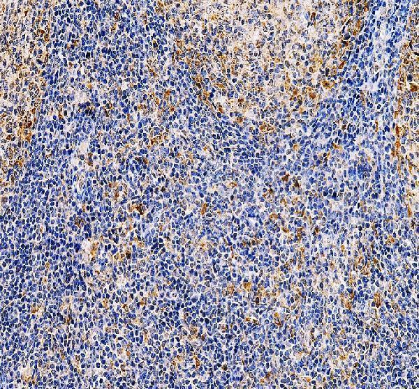 a13513 1 fcrl6 primary antibodies ihc testing 1
