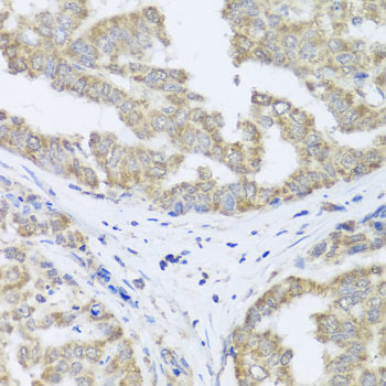 a13519 timm10b primary antiboties ihc testing 2