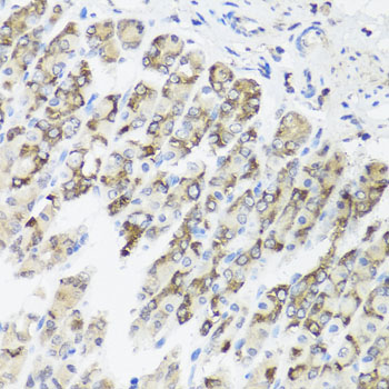 a13519 timm10b primary antiboties ihc testing 3
