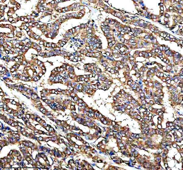  IHC analysis of QRSL1 using anti-QRSL1 antibody (A13528-2)