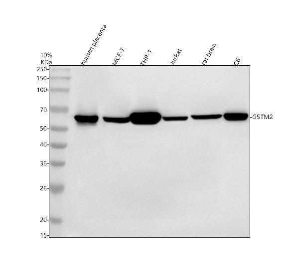  Western blot analysis of QRSL1 using anti-QRSL1 antibody (A13528-2)