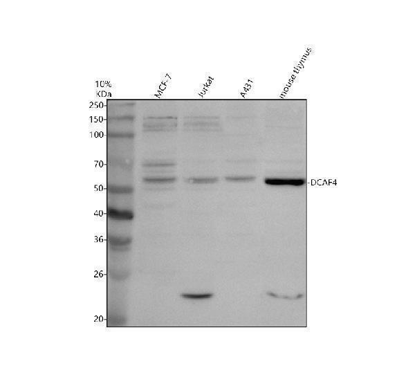 a13531 1 dcaf4 primary antibodies wb testing 1