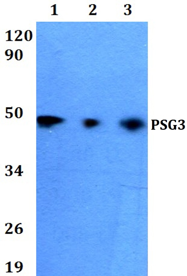 Western blot (WB) analysis of PSG3 polyclonal antibody at 1:500 dilution
Lane1:HEK293Twhole cell lysate
Lane2:Raw264