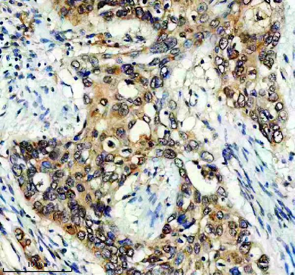 a13540 2 lratd2 primary antibodies ihc testing 1