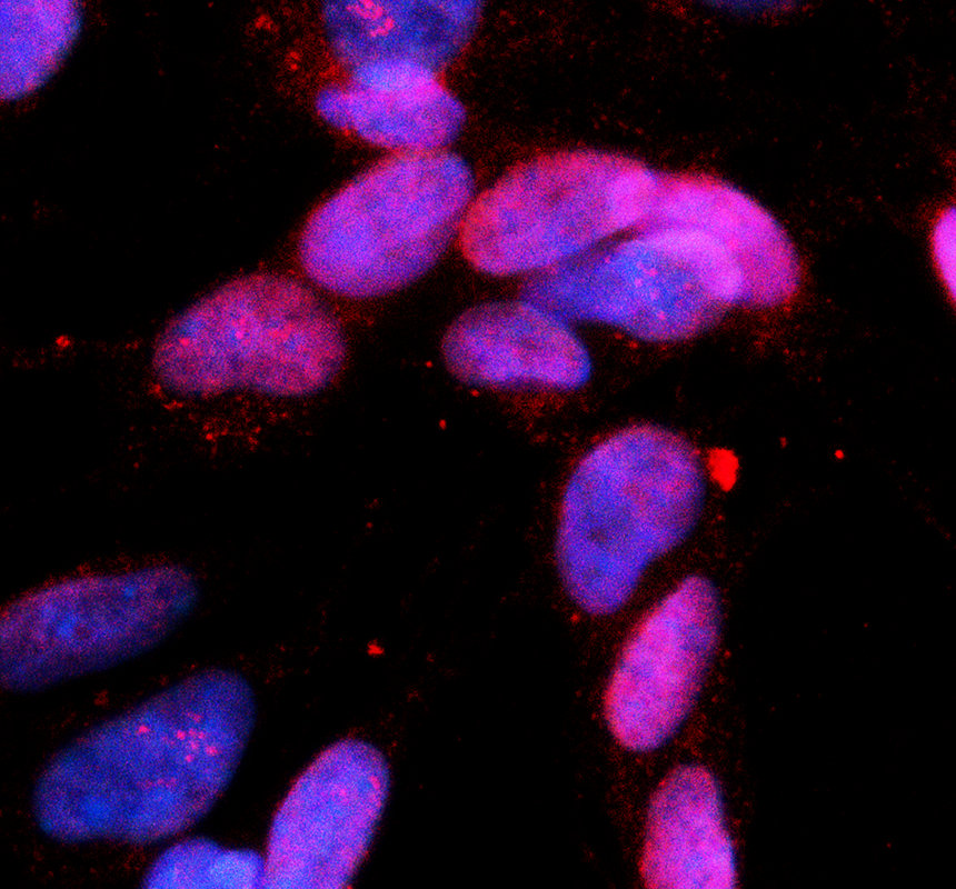 IF analysis of KY using anti-KY antibody (A13557)