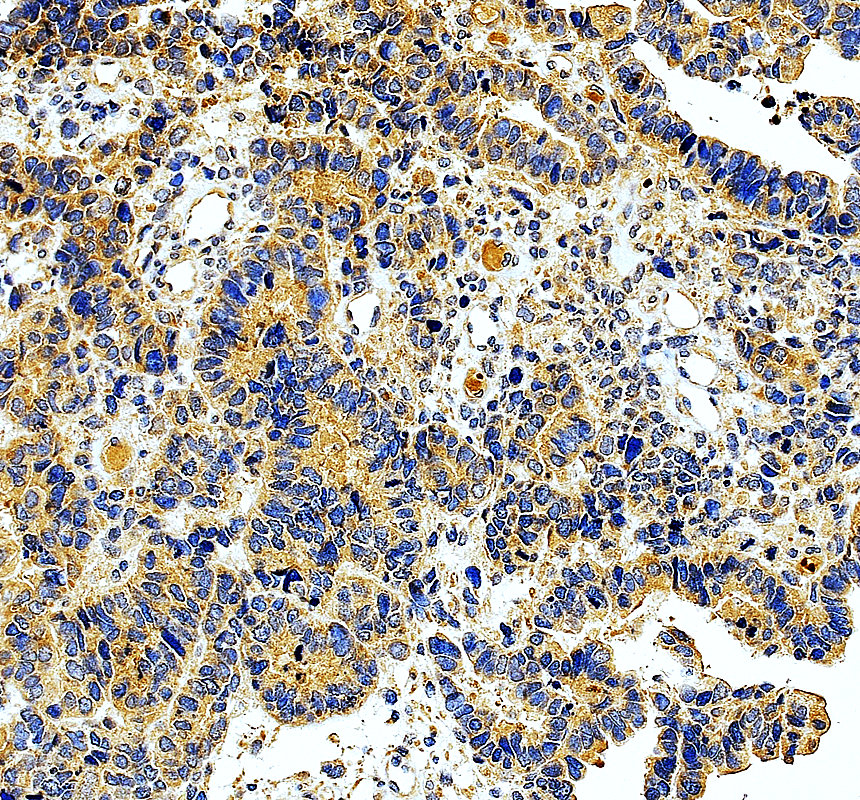 IHC analysis of KY using anti-KY antibody (A13557)