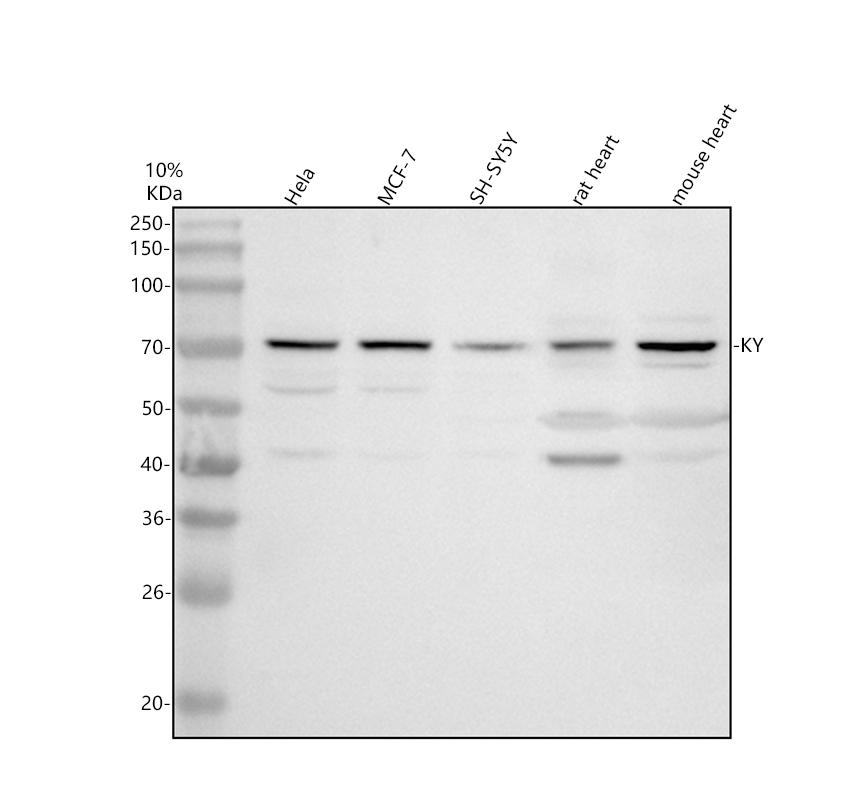 Western blot analysis of KY using anti-KY antibody (A13557)