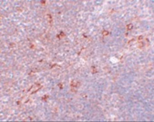 Immunohistochemistry of NAT11 in mouse thymus tissue with NAT11 antibody at 5 μg/mL