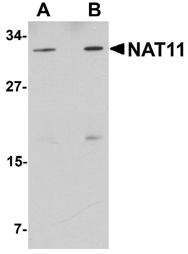 Western blot analysis of NAT11 in human thymus tissue lysate with NAT11 antibody at (A) 1 and (B) 2 μg/mL