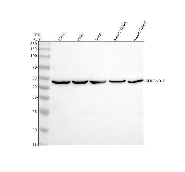 Western blot analysis of SERPINB12 using anti-SERPINB12 antibody (A13578-2)