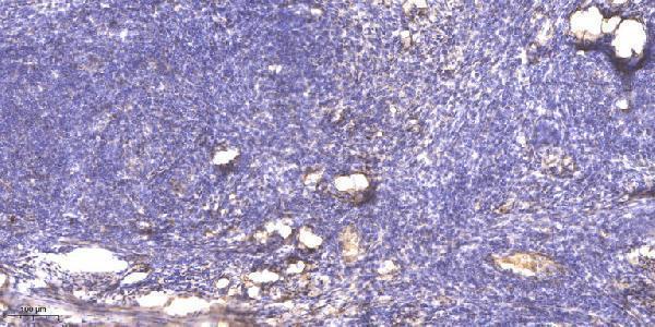 a13578 serpinb12 primary antibodies ihc testing 1