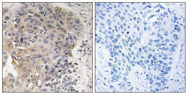 a13582 agbl3 primary antibodies ihc testing 1