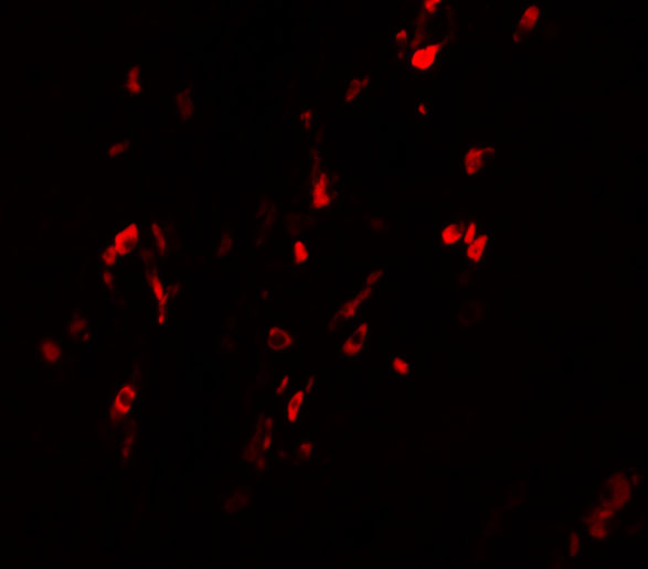 Immunofluorescence of BCAS1 in Human Breast Carcinoma cells with BCAS1 antibody at 20 μg/mL