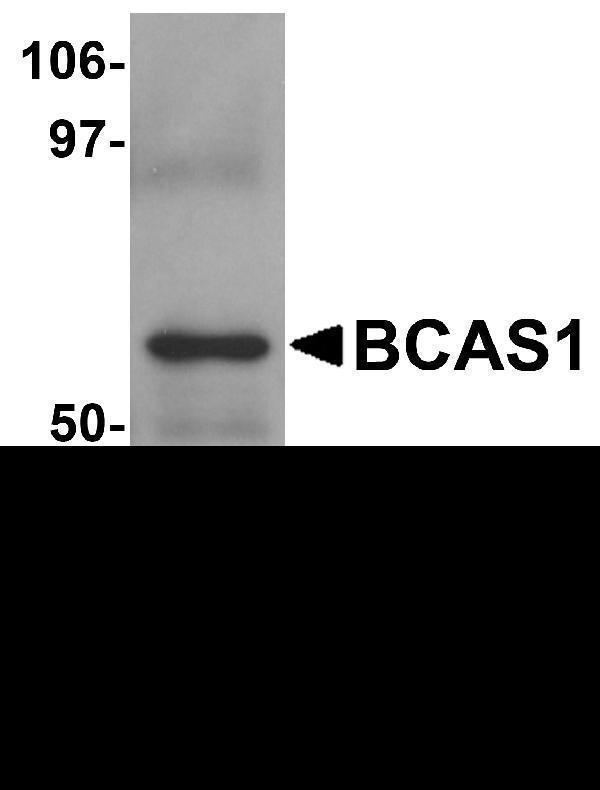 Western blot analysis of BCAS1 in human lung tissue lysate with BCAS1 antibody at 1 μg/mL