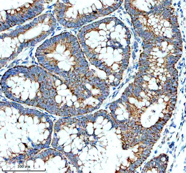 IHC analysis of RRP15 using anti-RRP15 antibody (A13592-2)