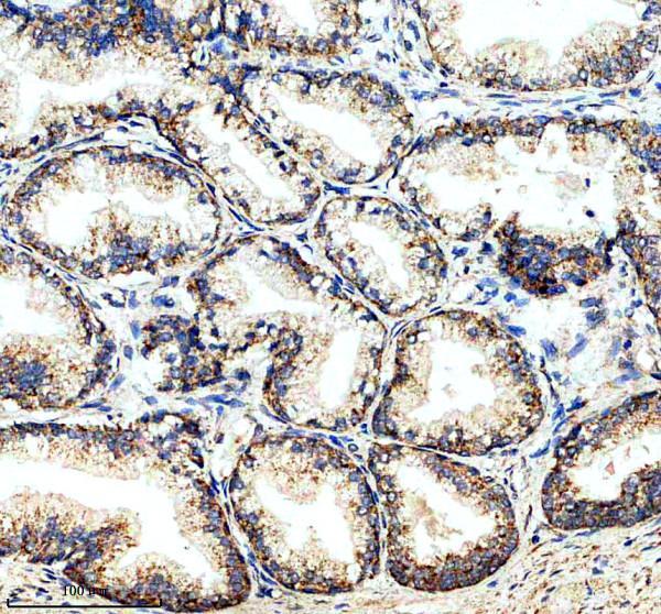IHC analysis of RRP15 using anti-RRP15 antibody (A13592-2)