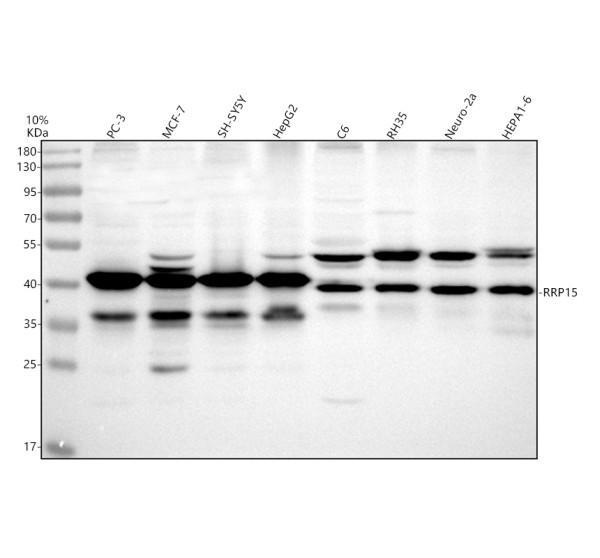 Western blot analysis of RRP15 using anti-RRP15 antibody (A13592-2)