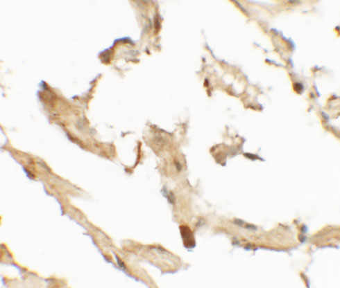 a13595 wdr18 primary antibodies ihc testing 2