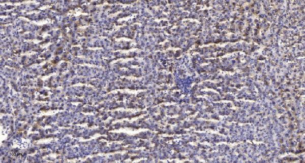a13598 mrpl22 primary antibodies ihc testing 1