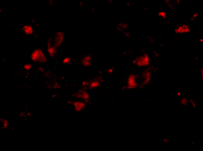 Immunofluorescence of JPH4 in Human Brain cells with JPH4 antibody at 20 μg/mL