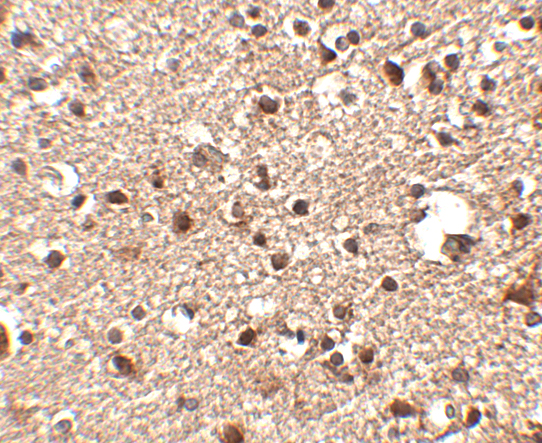 Immunohistochemistry of JPH4 in human brain tissue with JPH4 antibody at 2