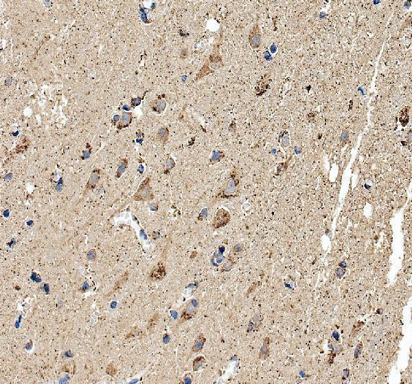 a13621 1 gpr32 primary antibodies ihc testing 1