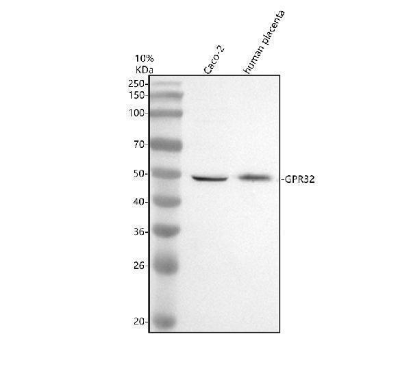 a13621 1 gpr32 primary antibodies wb testing 1