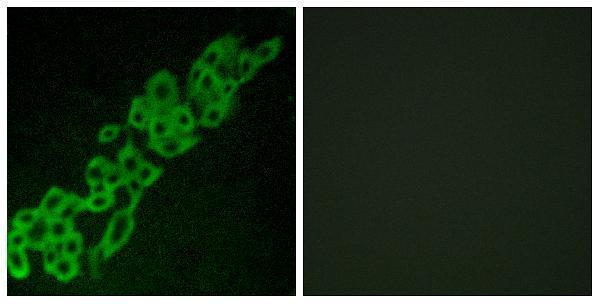 a13621 gpr32 primary antibodies if testing 1