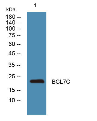 Western blot analysis of lysates from DU145 cells, primary antibody was diluted at 1:1000, 4°over night